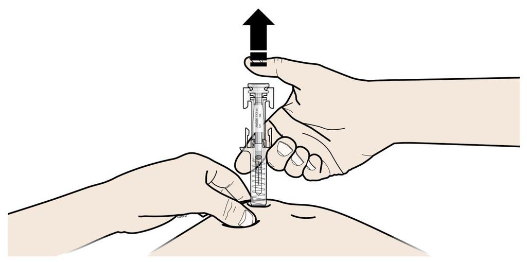 PSTRYK C Ważne, aby naciskać tłok aż do pstryknięcia w celu wstrzyknięcia pacjentowi pełnej dawki. ZWOLNIĆ kciuk.