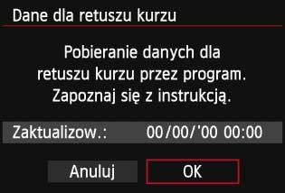 Dane dla retuszu kurzu używane przez dołączone oprogramowanie Digital Photo Professional (str. 457) pozwalają na automatyczne usuwanie drobinek kurzu z obrazów.