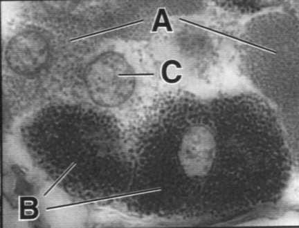 PODWZGÓRZE akson ziarno wydzielnicze kula Herringa Dwa szlaki podwzgórze-przysadka: małe komórki neurosekretoryczne (jąder drobnokomórkowych) duże komórki produkują czynniki (hormony)