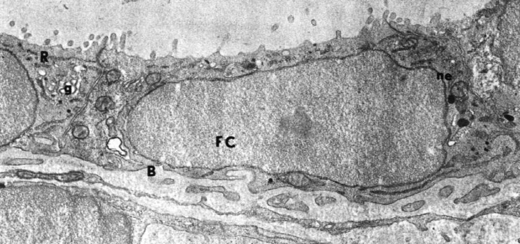 hydrolazowe Etapy produkcji hormonów tarczycowych T3 i T4: endocytoza TSH związany z receptorami