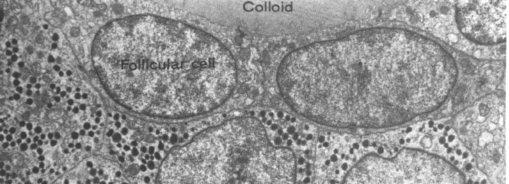 pęcherzykowej zachodzić jednocześnie aktywna Dlaczego w tarczycy są jednostki wydzielnicze