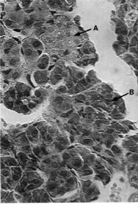 Komórki chromochłonne Naczynia