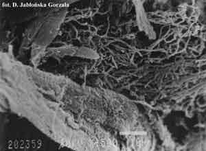 Strzępki "grzybni" promieniowca na substracie celulozowym. Preparat ze skaningowego mikroskopu elektronowego.