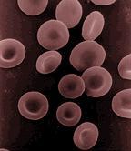 Spis treści 1 KREW 1.1 Erytrocyty (krwinki czerwone) 1.2 Leukocyty (krwinki białe) 1.3 Trombocyty (płytki krwi, płytki Bizzozera) i megakariocyty 1.4 Osocze krwi 1.5 Krzepnięcie krwi 2 SZPIK KOSTNY 2.