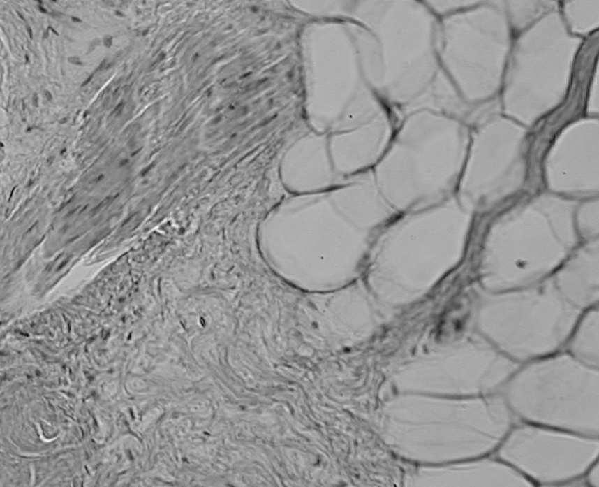 mechanoreceptory 2.