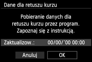 Dane dla retuszu kurzu używane przez dołączone oprogramowanie Digital Photo Professional (str. 364) pozwalają na automatyczne usuwanie drobinek kurzu z obrazów.