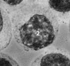 rybosomy mieloblast