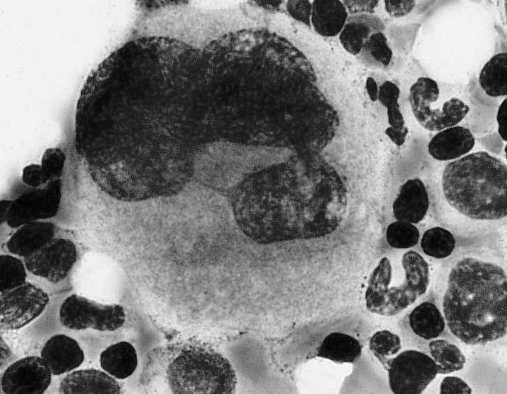 Powstawanie płytek krwi (linia trombopoezy) megakarioblast (endomitozy) promegakariocyt Megakariocyt do 100 µm do 64 n płatowate jądro obszary: - okołojądrowy (organelle) - pośredni (błony