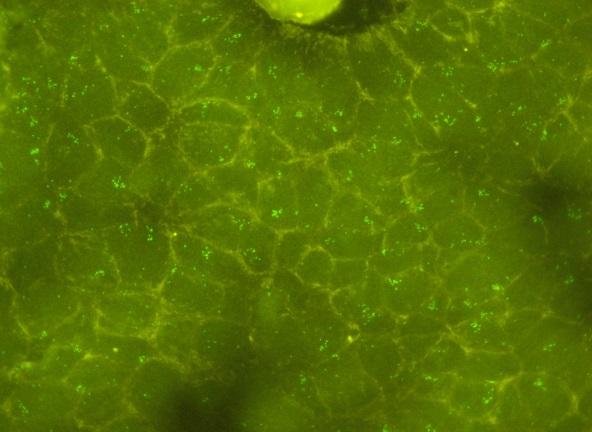 Definition of a fluorescence insitu hybridization score