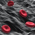 brzusznej i miednicy naczynia krwionośne: badania