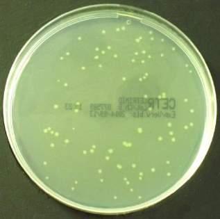 Rys 1. Wzrost Pseudominas aeruginosa ATCC 9027 na pożywce CN z cetrymidem. Rys 2. Wzrost Pseudomonas aeruginosa ATCC 27853 na pożywce CN z cetrymidem. 7.