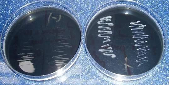 Badania potwierdzające Legionella CYE Agar (BCYE) proszek CM0655B 500 g 2,5g/90ml 11731-2:2008 Suplement do BCYE (z cysteiną) Legionella BCYE Medium (z cysteiną) Suplement SR0110A 10 szt.