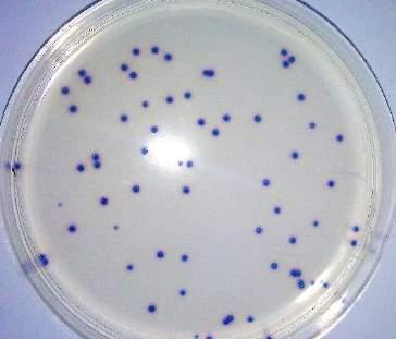 Rysunki od prawej: Escherichia coli WDCM 00013, Citrobacter freundii WDCM 00006, kultura mieszana Inne pożywki do oznaczania