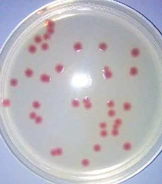 54,15 0,5 ml/l - PN EN ISO 9308-1: 2004/AC: 2009 Agar laktozowy z TCC i heptadecylosiarczanem sodu Płytki 55 Ø PO5411J 10 szt.