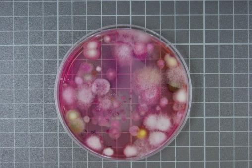 Zdjęcie nr 5. Morfologia kolonii grzybów mikroskopowych wyizolowanych z gleby nawożonej nawozem mineralnym spod roślin jabłoni odm. Topaz na podkładce M.9.