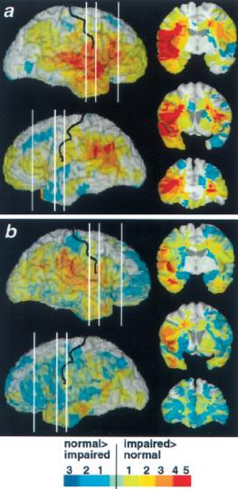 SPOSTRZEGANIE EMOCJI: MECHANIZMY NEURONALNE Zespół Damasia (Adolphs et al, 2000) przebadał 108 pacjentów z różnymi lezjami oraz 30 zdrowych ochotników jak radzą sobie oni w trzech zadaniach zw.