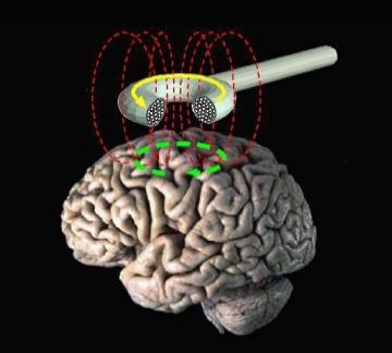 SPOSTRZEGANIE EMOCJI: MECHANIZMY NEURONALNE Pitcher et al (2008) w badaniu z u ż y c i e m p r ze z c z a s z kowe j stymulacji magnetycznej