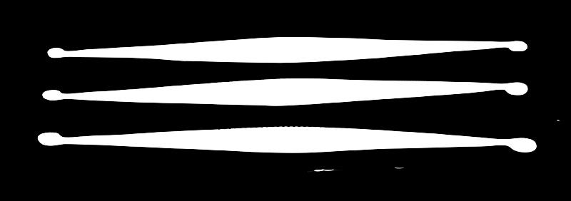 43 90 Denmax : 9012,1 Łyżeczka zębodołowa dwustronna Hemingway 18,5 cm Służy do usuwania ziarniny z zębodołu, wyłuszczania zmian zapalnych oraz usuwania odłamanych części zęba i przegrody