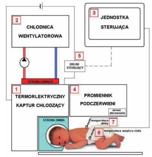 3. Warianty systemu chłodzenia mózgu noworodka Wyróżniamy trzy podstawowe warianty systemu chłodzenia mózgu noworotka: Bezpośredni system chłodzenia mózgu Pośredni system chłodzenia mózgu Hybrydowy