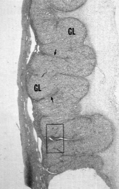 Atrezja pęcherzyków jajnikowych Ciałko żółte komórki ziarnisto-luteinowe komórki osłonkowo-luteinowe naczynia