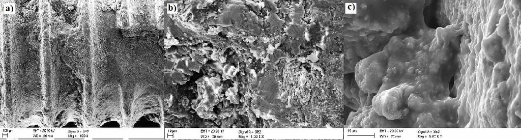 54 Krauz D., Ziębowicz A., Bączkowski B. Badanie SEM powierzchni implantu stomatologicznego przeprowadzono w mikroskopie skaningowym firmy ZEISS SUPRA 35 wyposażonym w detektor SE.