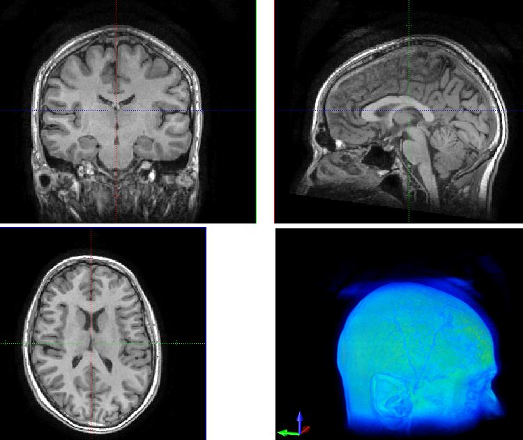 Mózg Organizacja przedmiotu Neuron biologiczny Sztuczne sieci neuronowe Sztuczna inteligencja Płat czołowy (Frontal lobe) Płat ciemieniowy (Parietal lobe) Płat potyliczny