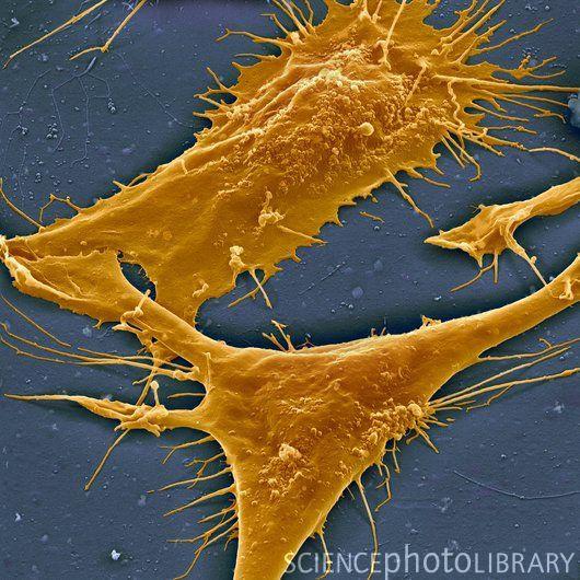 Fibroblasty Główne komórki tkanki łącznej Wytwarzają substancję podstawową i włókna tkanki łącznej oraz stromelizynę (metaloproteinaza) Kształt wrzecionowaty Odmiany fibroblastów: melanofory i