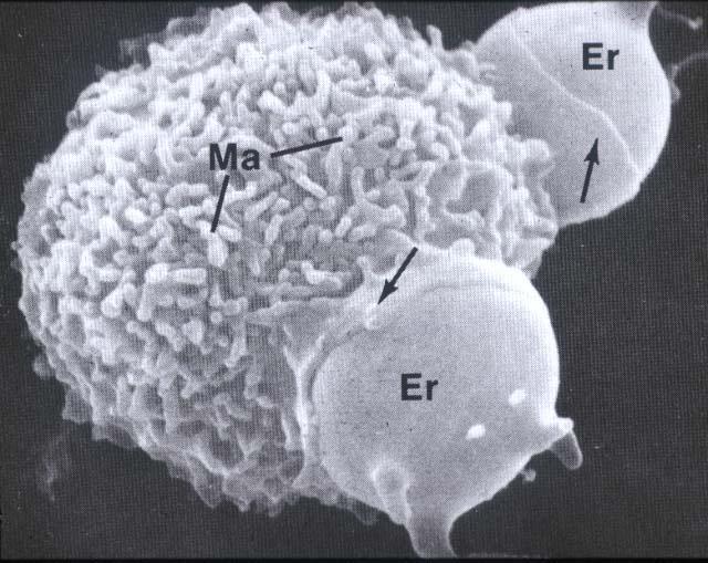podstawowej 2. Prezentacja antygenów limfocytom - element odpowiedzi zapalnej (komórka APC, ang.
