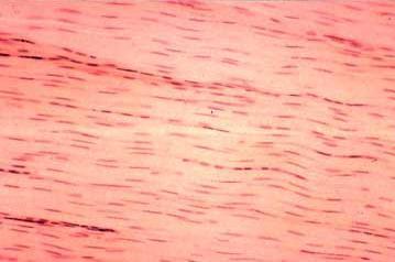 Tkanka łączna włóknista zbita: - duża ilość gęsto upakowanych włókien kolagenowych (typ I i III) i elastycznych - zawiera niewiele komórek i