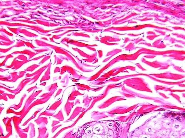 kolagenowych (typ I) i sprężystych ścięgna, torebki stawowe fibrocyty między pęczkami włókien kolagenowych układają się w szeregi Ranviera układ
