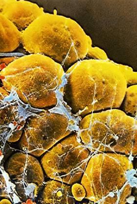 Jednokomorowa (żółta = biała) tkanka tłuszczowa Komórki: duże (średnica: 50-150 µm) wyglądają jak sygnet duże krople tłuszczu w cytoplazmie jądro położone jest na obrzeżach i jest spłaszczone