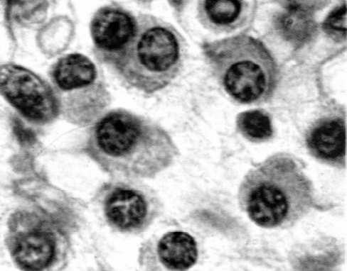 receptorów) Komórki plazmatyczne (plazmocyty) produkują immunoglobuliny Rodzina makrofagów