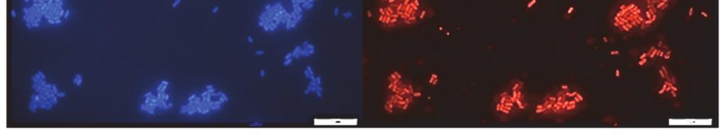 [B2]; cells hybridized with Lplan probe