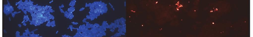 of Lactobacillus 2; cells stained