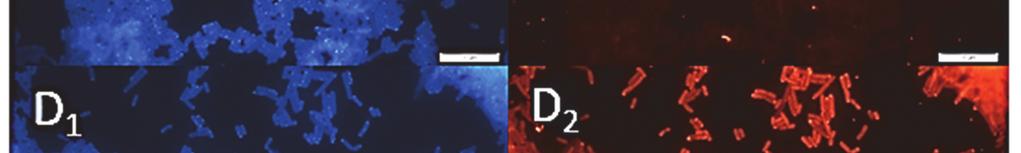 hybridized with Eub338 probe [A2];