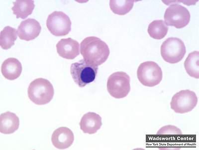 Red cell Istnieją dwa typy krwinek - czerwone krwinki są wypełnione specjalnym środkiem chemicznym pozwalającym na przenoszenie tlenu.