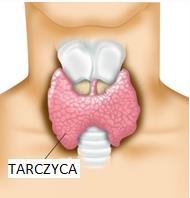 Terapia I-131» Ta