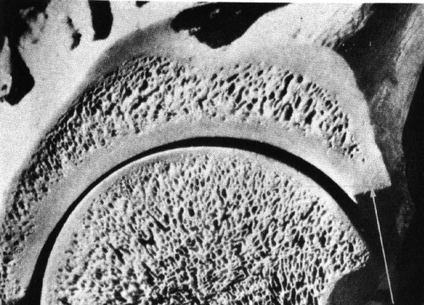 dojrzałej (blaszkowatej) kości jest blaszka kostna 3-5 µm (1)