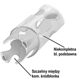 międzykomórkowe blaszka podstawna nieciągła lub