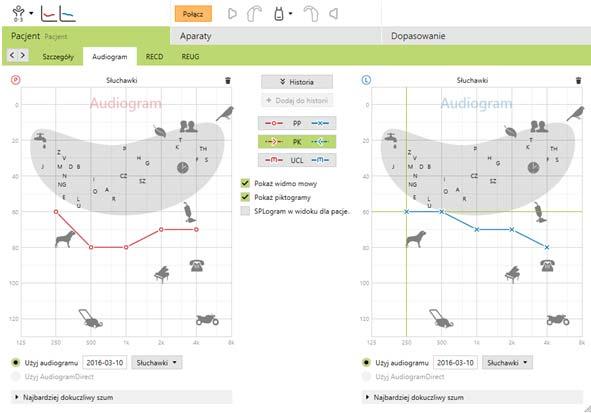 Dane pacjenta Audiogram Audiogram można powiększać i przeglądać. Kliknij na [Pacjent], następnie [Audiogram], aby go zobaczyć. W celu powiększenia kliknij [Widok pacjenta].