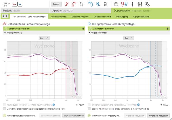 Wyniki pomiarów testu sprzężenia są wyświetlane w postaci ciągłej, purpurowej linii.