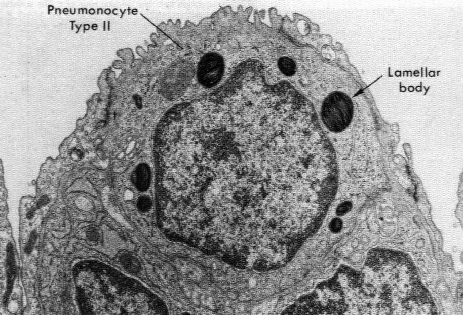 śródbłonkowej pneumocyt typu I blaszki podstawne komórka