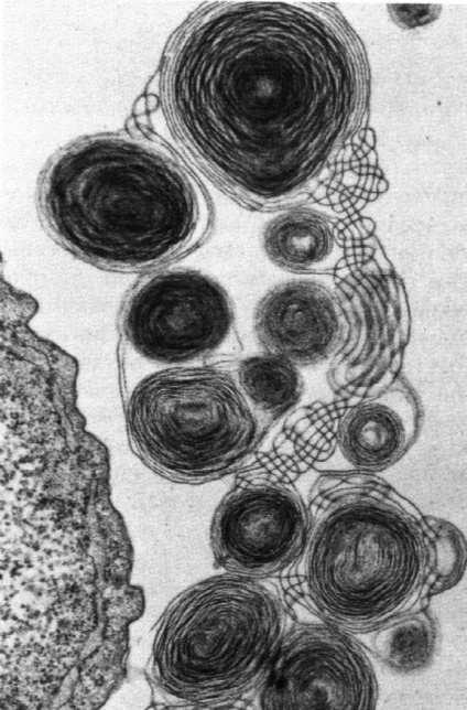 blaszkowate) Pneumocyt typu II Ciałko blaszkowate