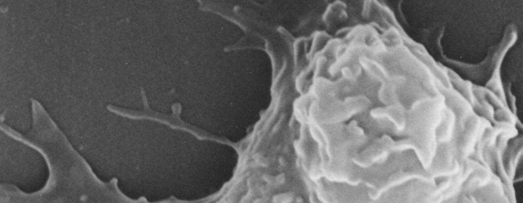 Makrofagi fagocytują