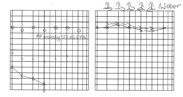 Audiogram Pacjenta A wykonany w innym ośrodku Figure 1.