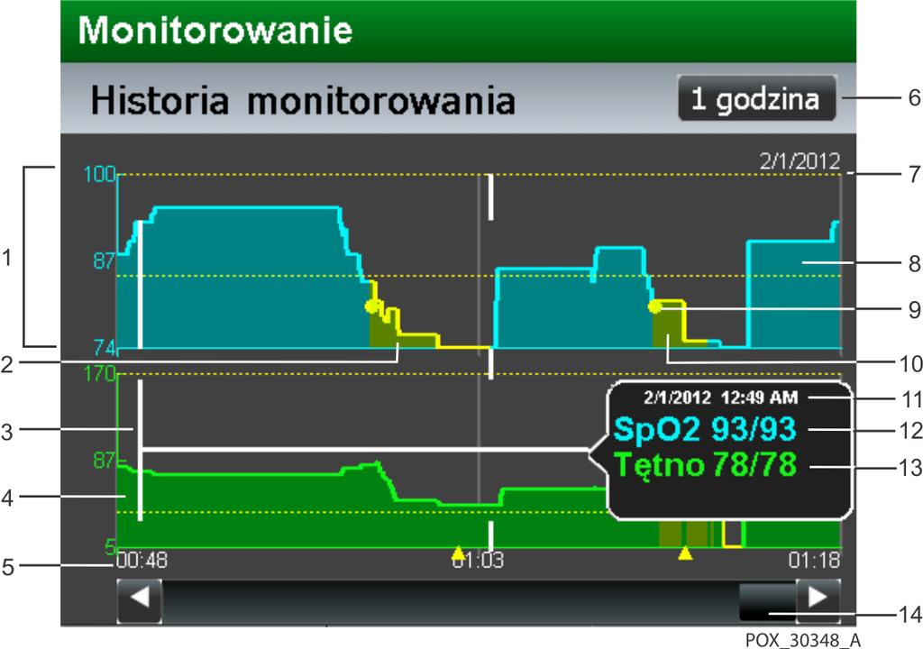 Dostęp do danych trendów Graficzny widok trendu Graficzny widok trendu oferuje użytkownikom dostęp do ciągłych danych trendu z okresu od 15 minut do 48 godzin. Rysunek 5-1.