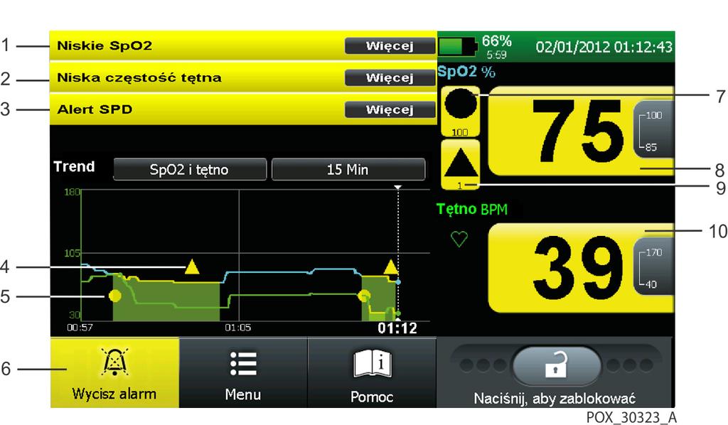 2 Alarm NISKIE TĘTNO Częstość tętna pacjenta spadła poniżej dolnego progu częstości tętna. 3 Alarm ALARM SPD U pacjenta występuje wiele, sekwencyjnych faz desaturacji.