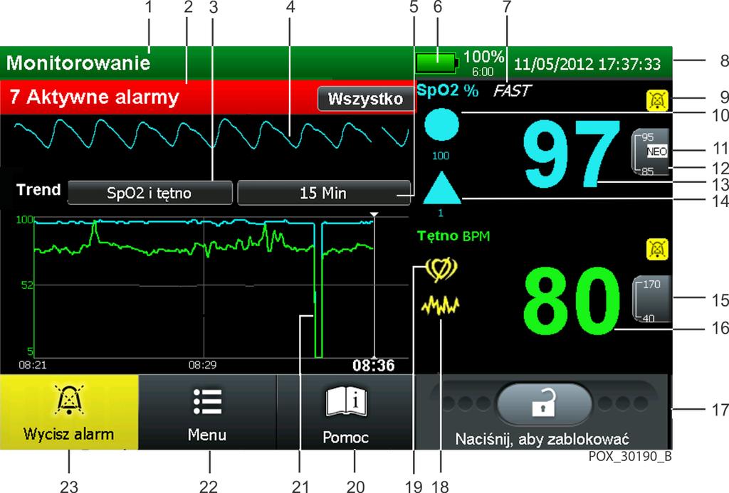 Widoki produktu 2.6.2 Ekran monitorowania Rysunek 2-2. Przykładowe elementy Ekran monitorowania 1 --- Pole stanu monitora Zawiera informacje o pacjencie.