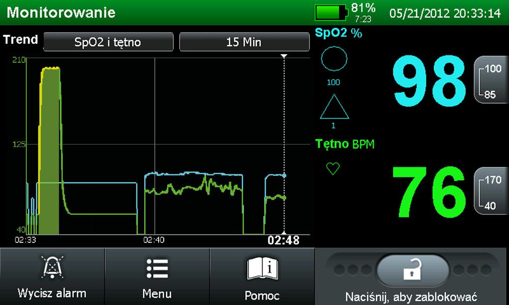 Interfejs użytkownika SPD Parametr Użyj parametru Alarm SPD (SPD) do wykrycia wzorów desaturacji w trendzie SpO2 u osób dorosłych.