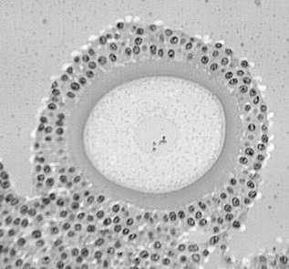 płynem (liquor folliculi zawiera kwas hialuronowy, białka osocza) warstwa ziarnista